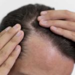 5 Essential tips to Prevent hair loss tips- Phootra